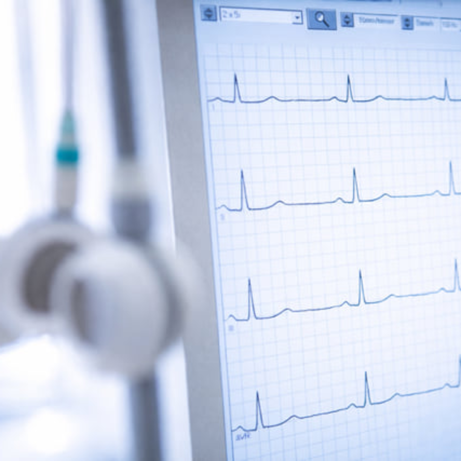 Foto eines medizinischen Monitors, der die Ausschl&auml;ge eines EKGs Zeigt