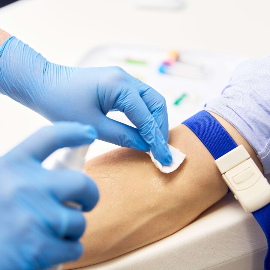 Nahaufnahme eines Armes, der gerade desinfiziert wird.