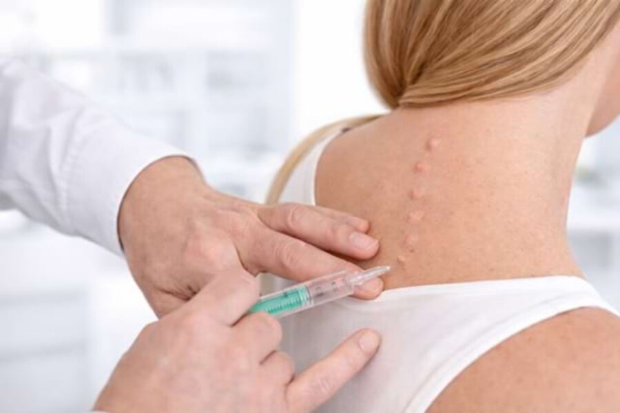 Nahaufnahme einer Quaddeltherapie am Nacken einer Patientin.